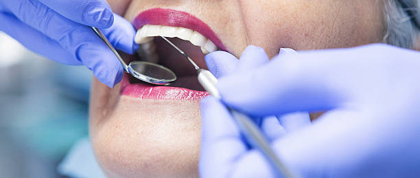 Best Emergency Wisdom Tooth Extraction in San Felipe, TX